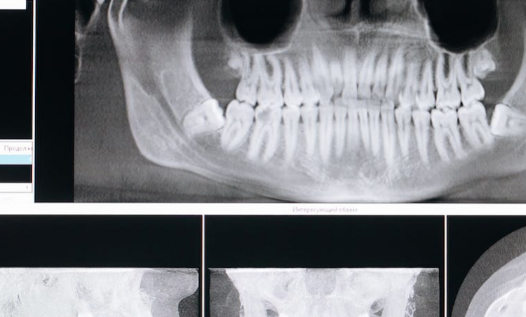 rentgen zębów poznań